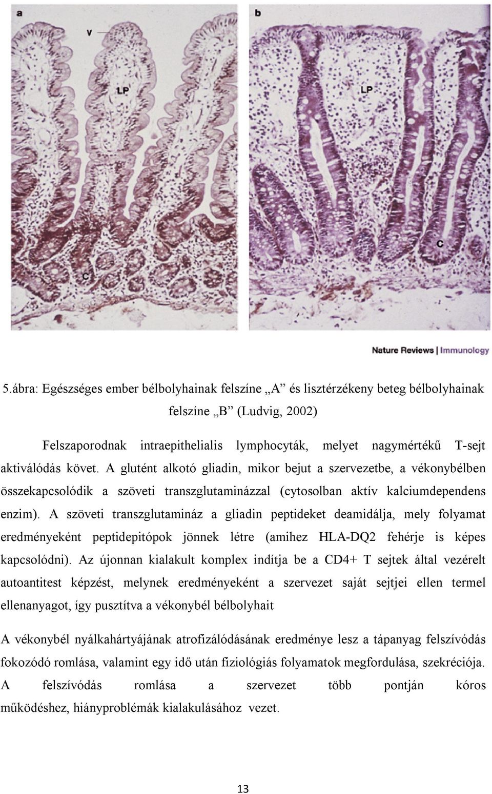 A szöveti transzglutamináz a gliadin peptideket deamidálja, mely folyamat eredményeként peptidepitópok jönnek létre (amihez HLA-DQ2 fehérje is képes kapcsolódni).