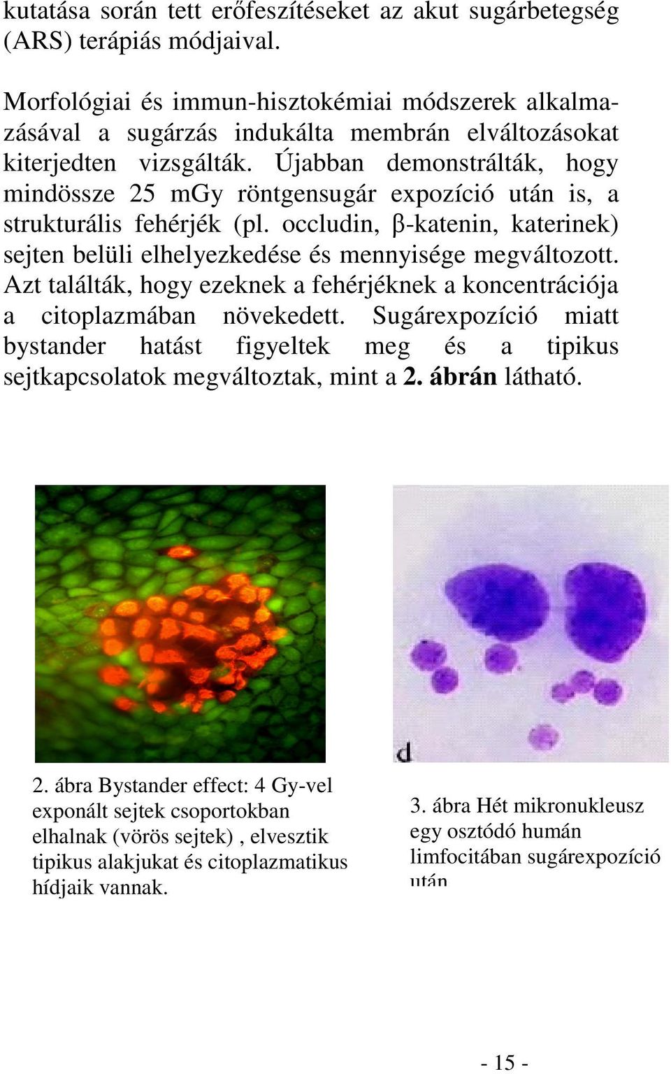 Újabban demonstrálták, hogy mindössze 25 mgy röntgensugár expozíció után is, a strukturális fehérjék (pl. occludin, -katenin, katerinek) sejten belüli elhelyezkedése és mennyisége megváltozott.