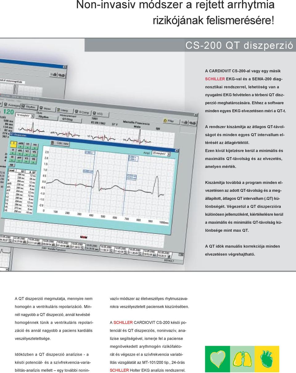 Ehhez a software minden egyes EKG elvezetésen méri a QT-t. A rendszer kiszámítja az átlagos QT-távolságot és minden egyes QT intervallum eltérését az átlagértéktöl.