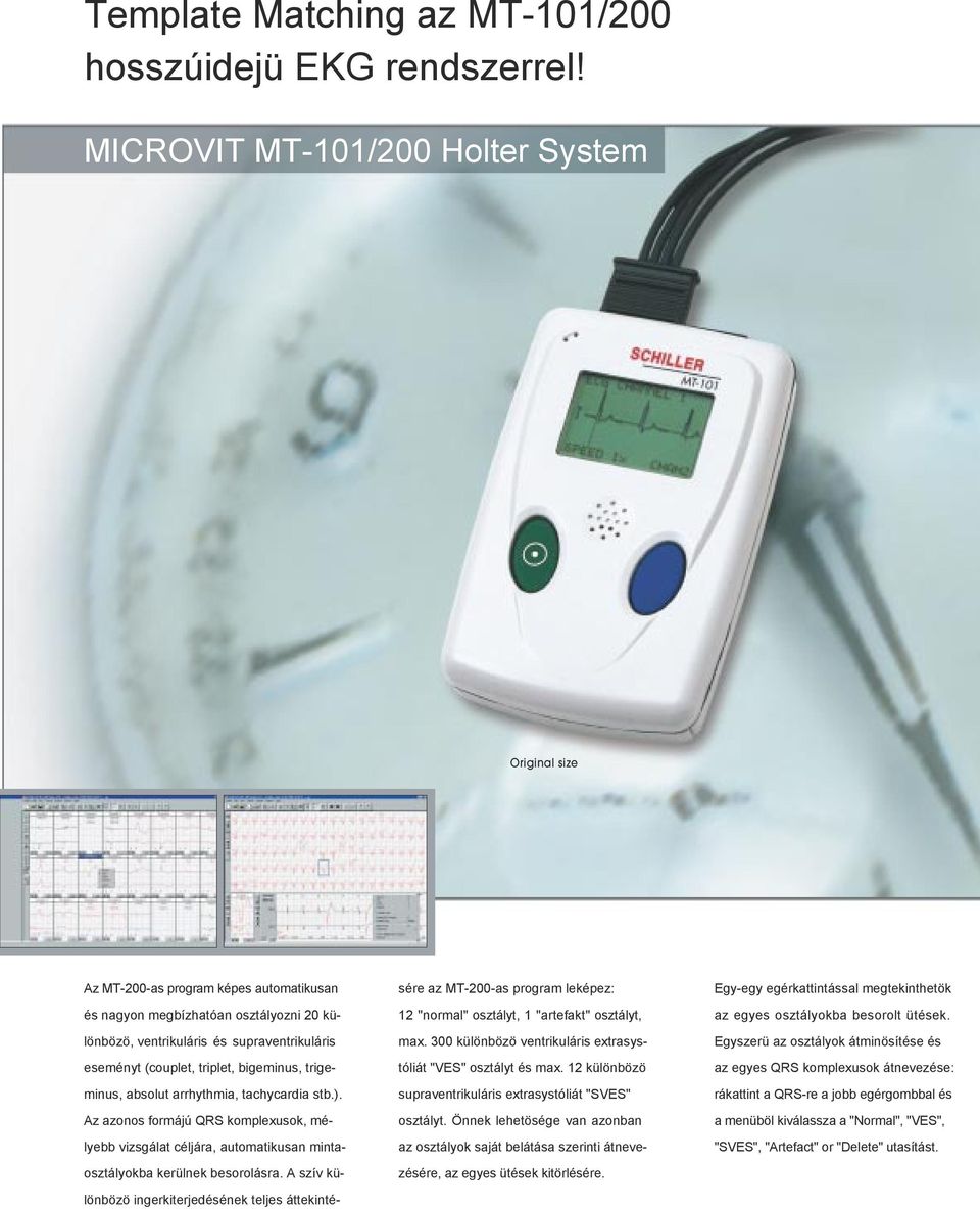 triplet, bigeminus, trigeminus, absolut arrhythmia, tachycardia stb.). Az azonos formájú QRS komplexusok, mélyebb vizsgálat céljára, automatikusan mintaosztályokba kerülnek besorolásra.