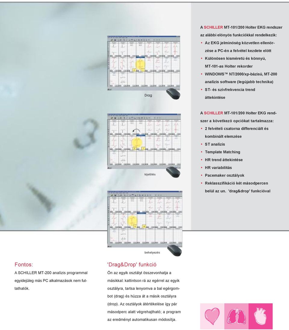 tartalmazza: 2 felvételi csatorna differenciált és kombinált elemzése ST analízis Template Matching HR trend áttekintése HR variabilitás kijelölés Pacemaker osztályok Reklasszifikáció két másodpercen