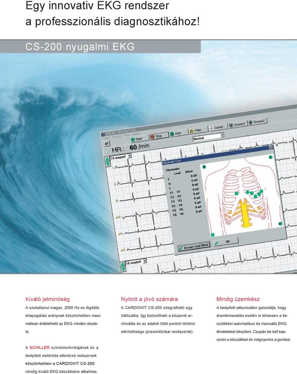 A SCHILLER szüréstechnikájának és a beépített elektróda ellenörzö redszernek köszönhetöen a CARDIOVIT CS-200 mindíg kiváló EKG készítésére alkalmas.