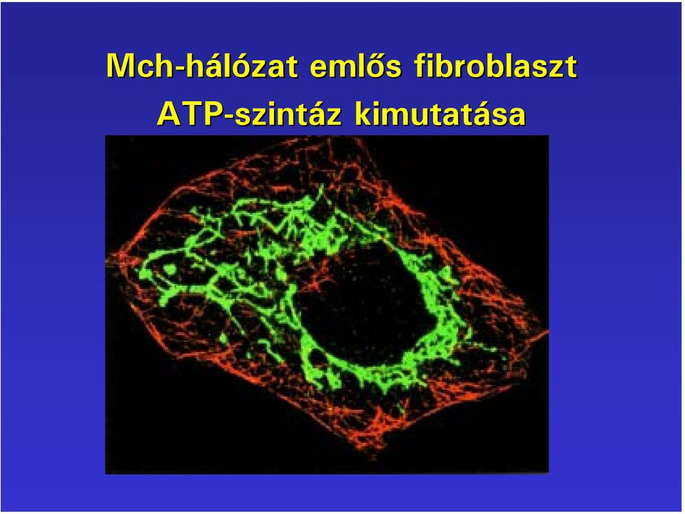 fibroblaszt