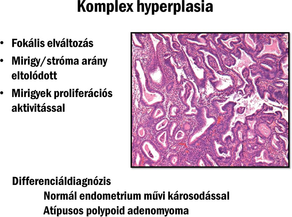 proliferációs aktivitással Differenciáldiagnózis