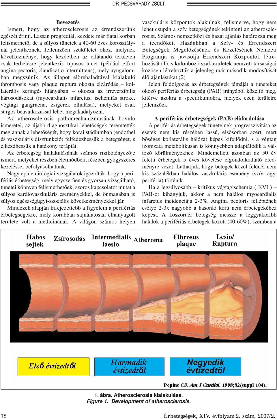 Jellemzõen szûkületet okoz, melynek következménye, hogy kezdetben az ellátandó területen csak terhelésre jelentkezik típusos tünet (például effort angina pectoris, claudicatio intermittens), mely