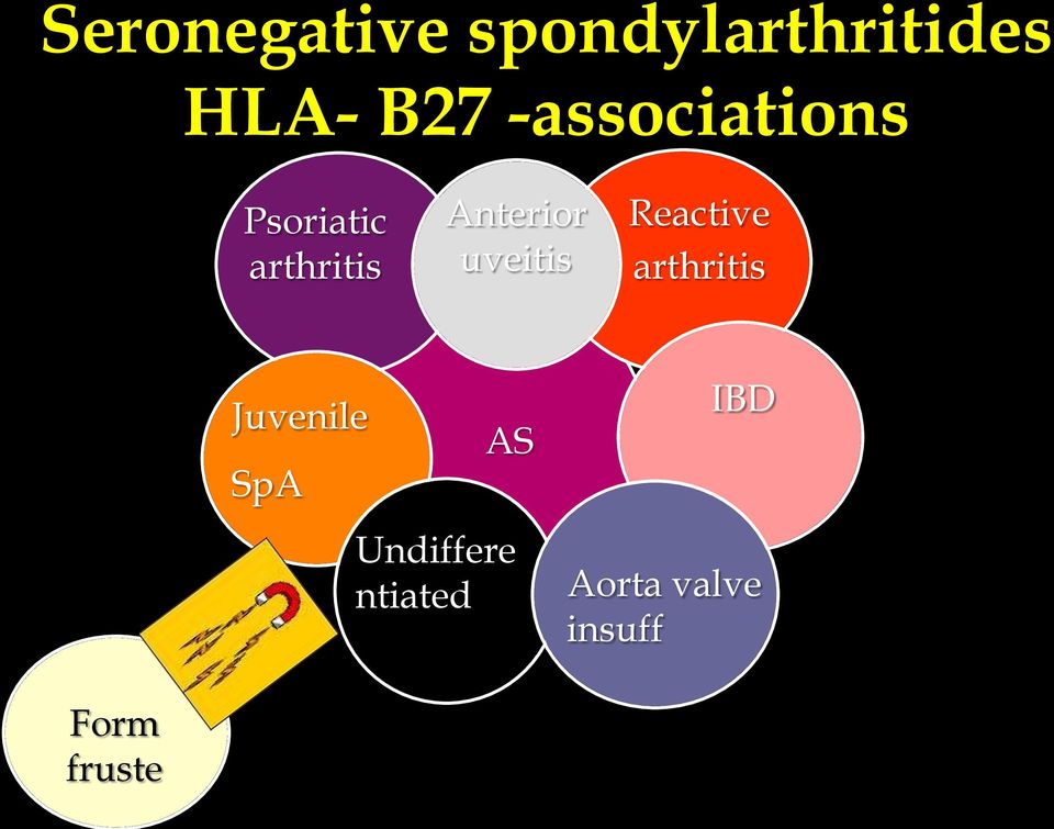 Diagnositic Criteria for Spondylarthropathy Arthritis Rheum 1991: 34:1218-27 Van der Linden SM.