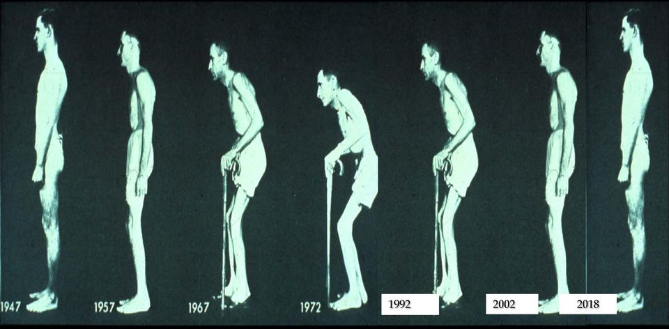 rokkantságát, tudjuk-e csökkenteni a cardiovascularis kockázatukat,