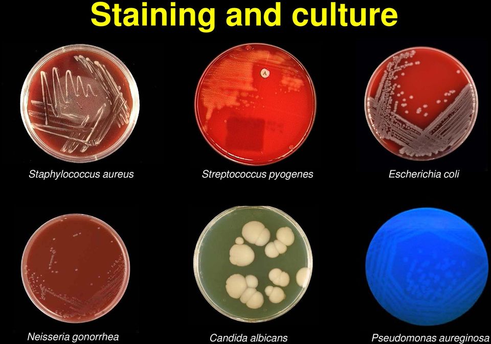 Escherichia coli Neisseria