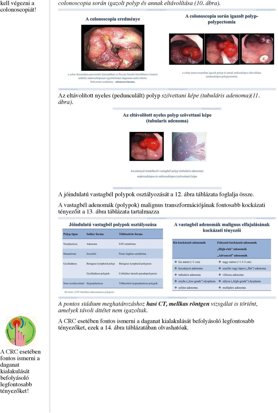 A vastagbél adenomák (polypok) malignus transzformációjának fontosabb kockázati tényezőit a 13.