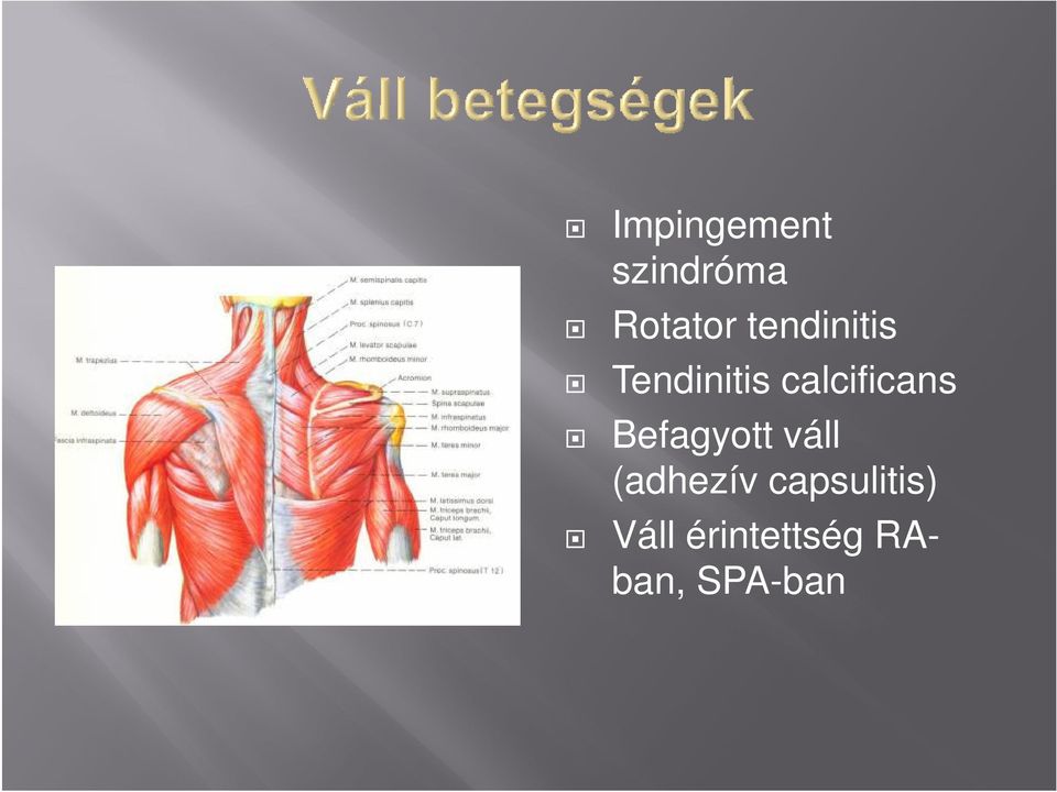 calcificans Befagyott váll