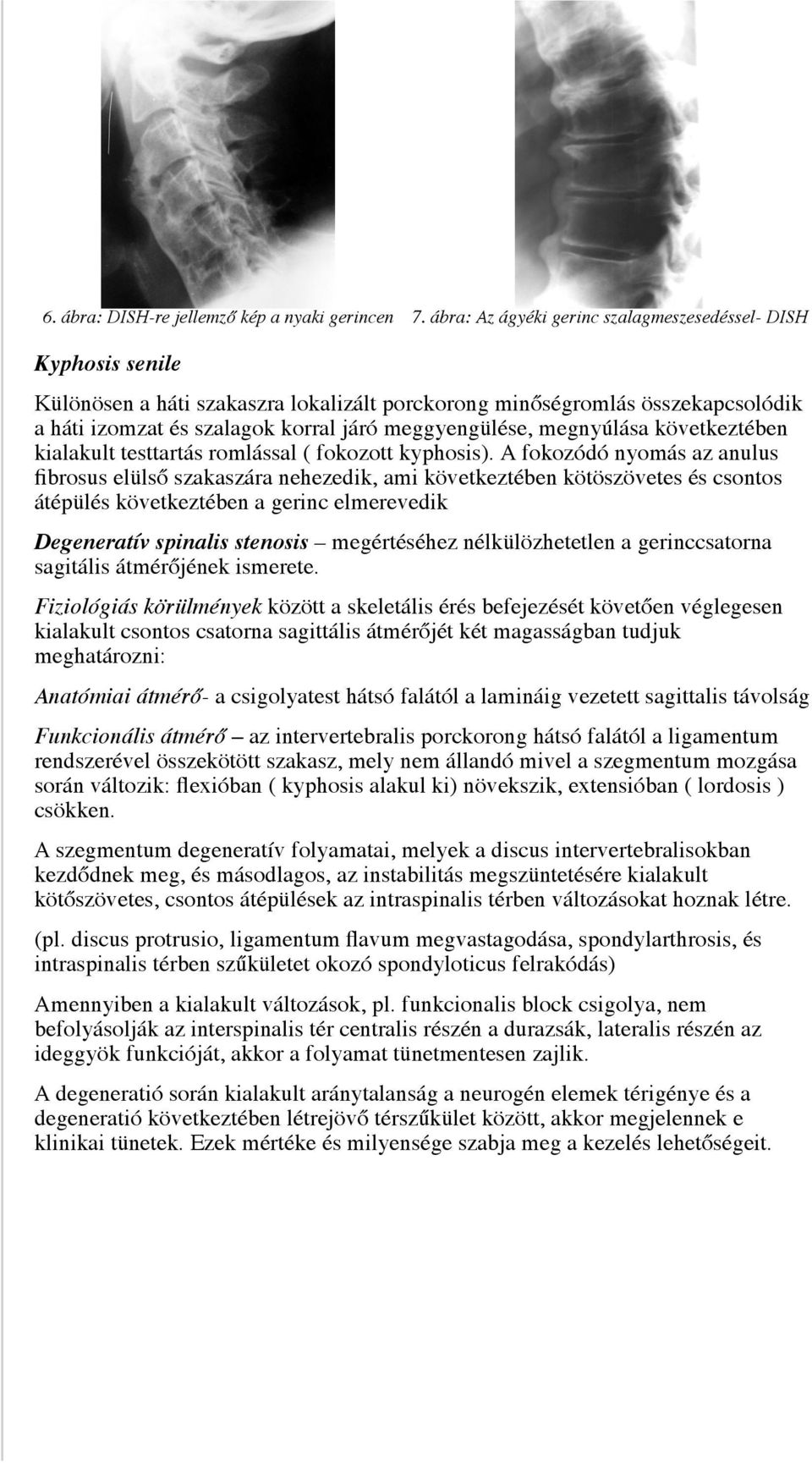 megnyúlása következtében kialakult testtartás romlással ( fokozott kyphosis).