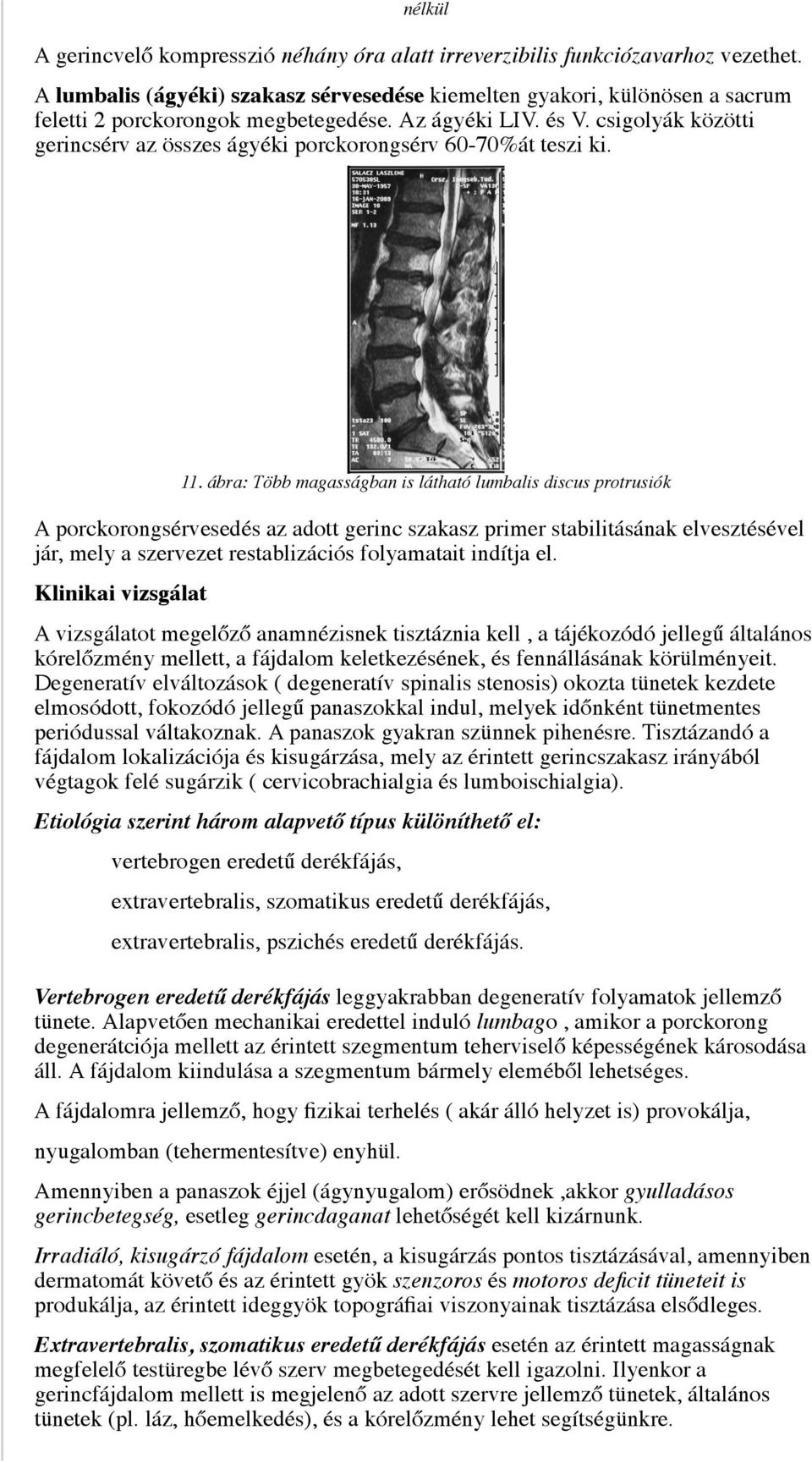 csigolyák közötti gerincsérv az összes ágyéki porckorongsérv 60-70%át teszi ki. 11.