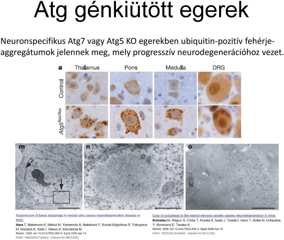 ubiquitin-pozitív fehérjeaggregátumok