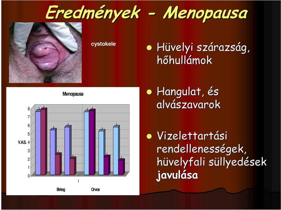 alvászavarok 7 6 5 V.A.S.