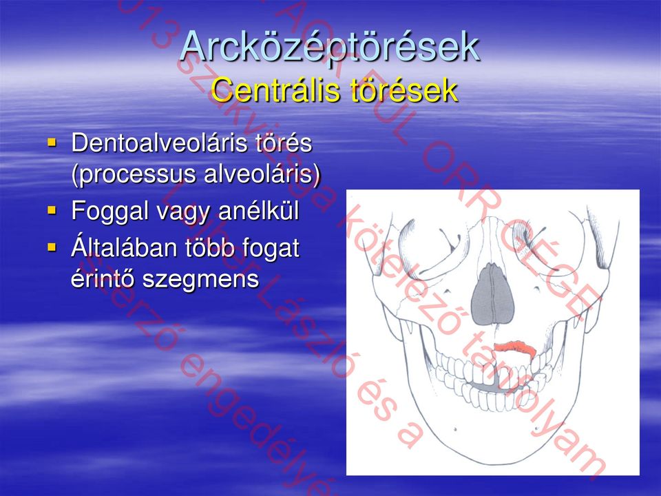 Foggal vagy anélkül Általában