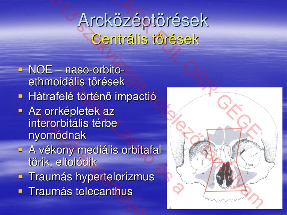 Az orrképletek az interorbitális térbe nyomódnak A vékony