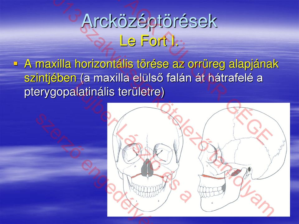 orrüreg alapjának szintjében (a maxilla