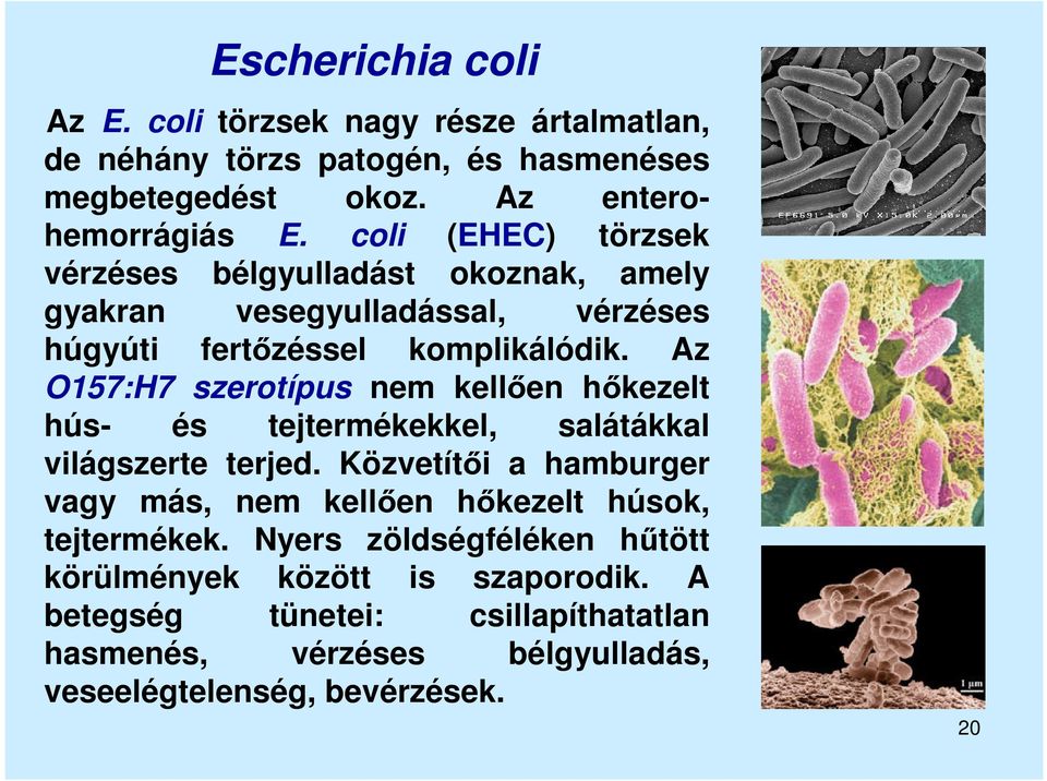 Az O157:H7 szerotípus nem kellően hőkezelt hús- és tejtermékekkel, salátákkal világszerte terjed.