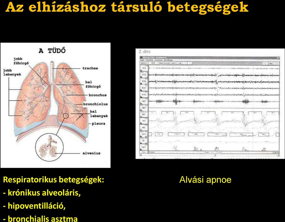 krónikus alveoláris, -