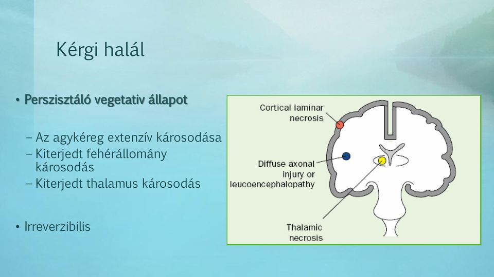 károsodása Kiterjedt fehérállomány