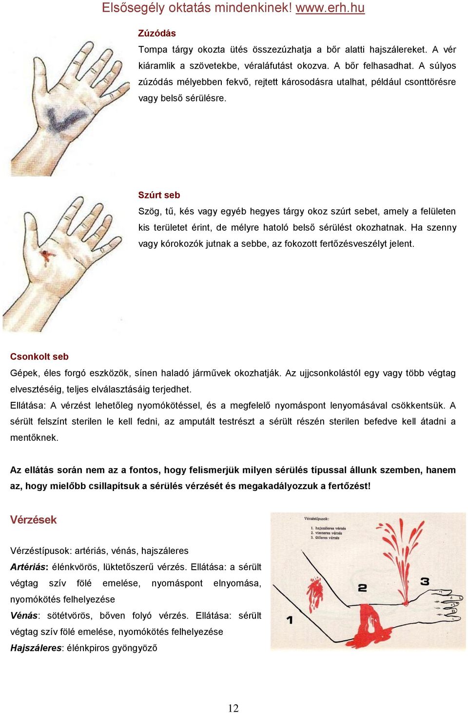 Szúrt seb Szög, tű, kés vagy egyéb hegyes tárgy okoz szúrt sebet, amely a felületen kis területet érint, de mélyre hatoló belső sérülést okozhatnak.