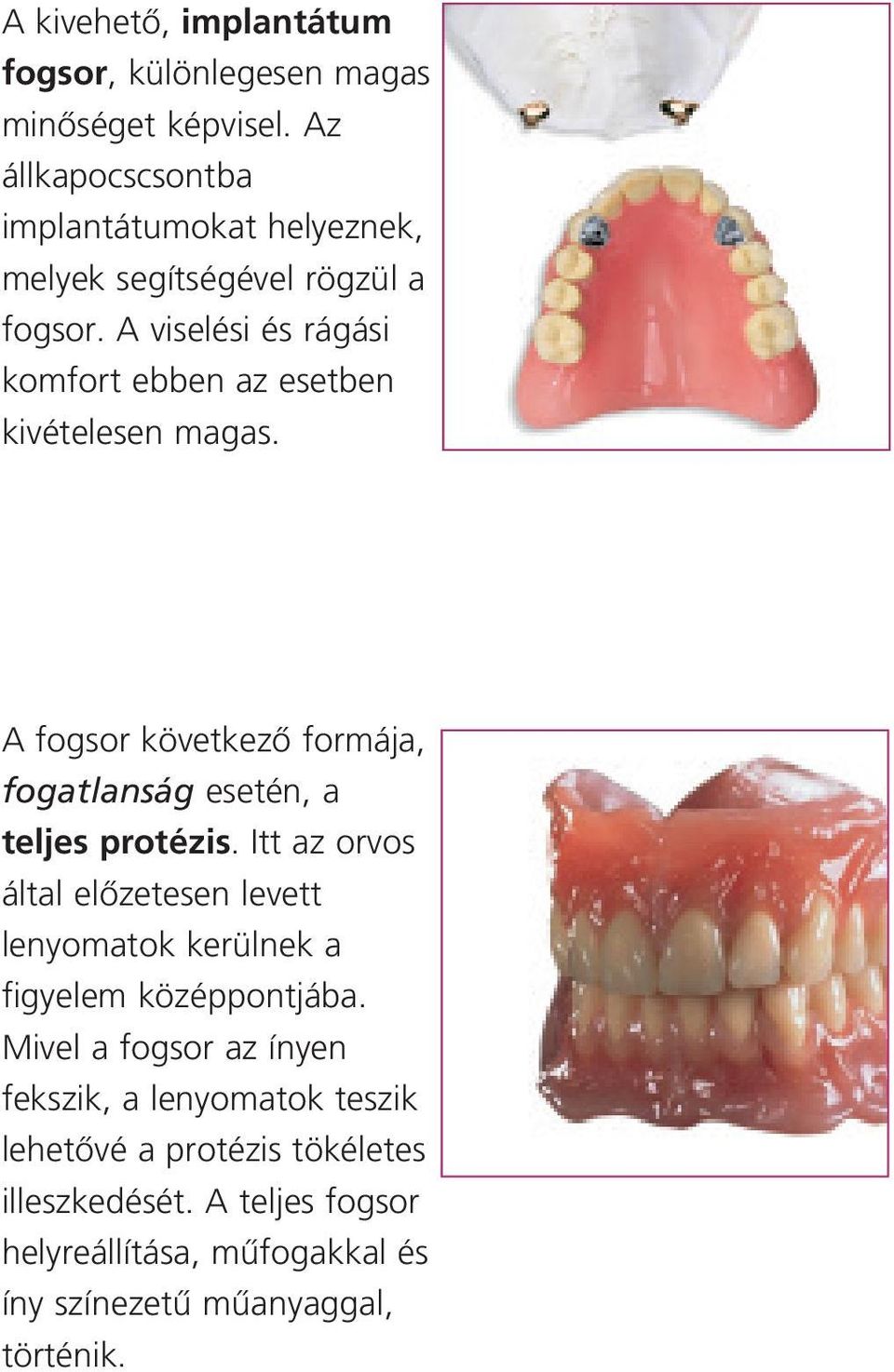 A viselési és rágási komfort ebben az esetben kivételesen magas. A fogsor következœ formája, fogatlanság esetén, a teljes protézis.