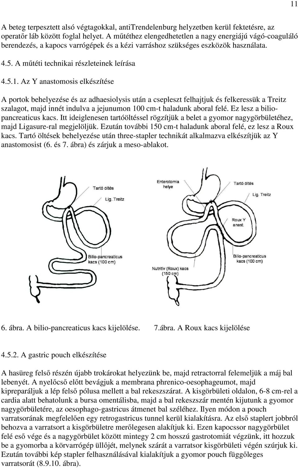 Az Y anastomosis elkészítése A portok behelyezése és az adhaesiolysis után a csepleszt felhajtjuk és felkeressük a Treitz szalagot, majd innét indulva a jejunumon 100 cm-t haladunk aboral felé.