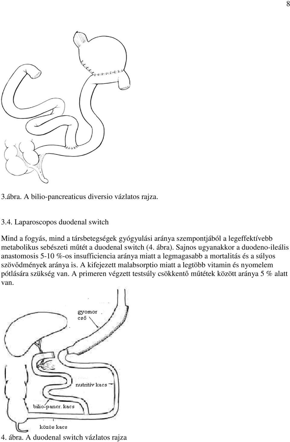 duodenal switch (4. ábra).