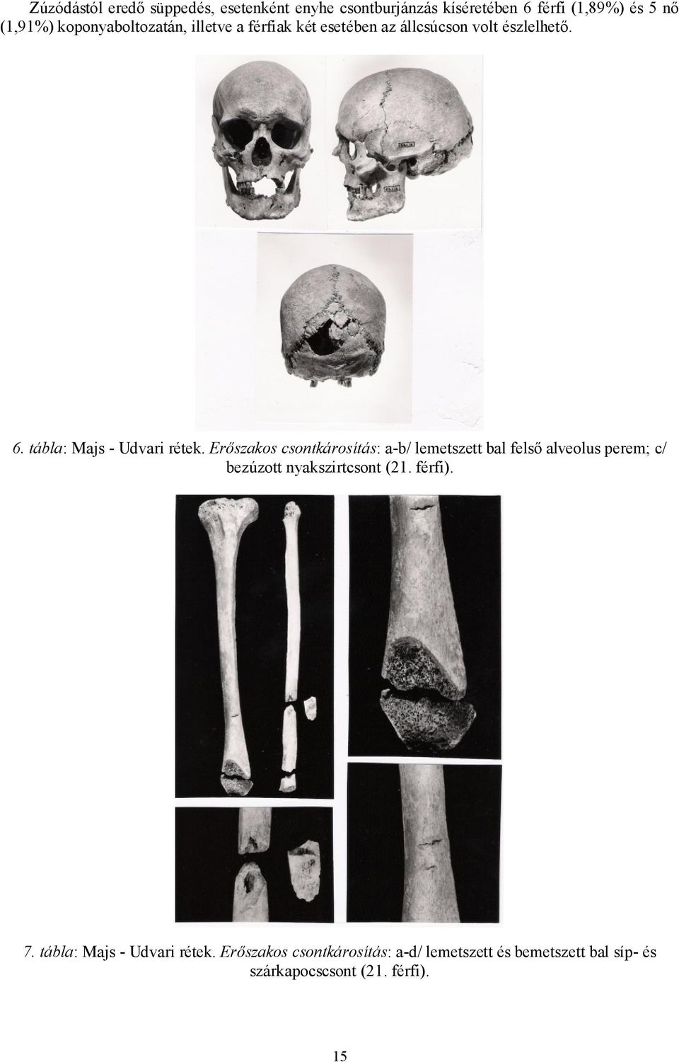 Erőszakos csontkárosítás: a-b/ lemetszett bal felső alveolus perem; c/ bezúzott nyakszirtcsont (21. férfi). 7.