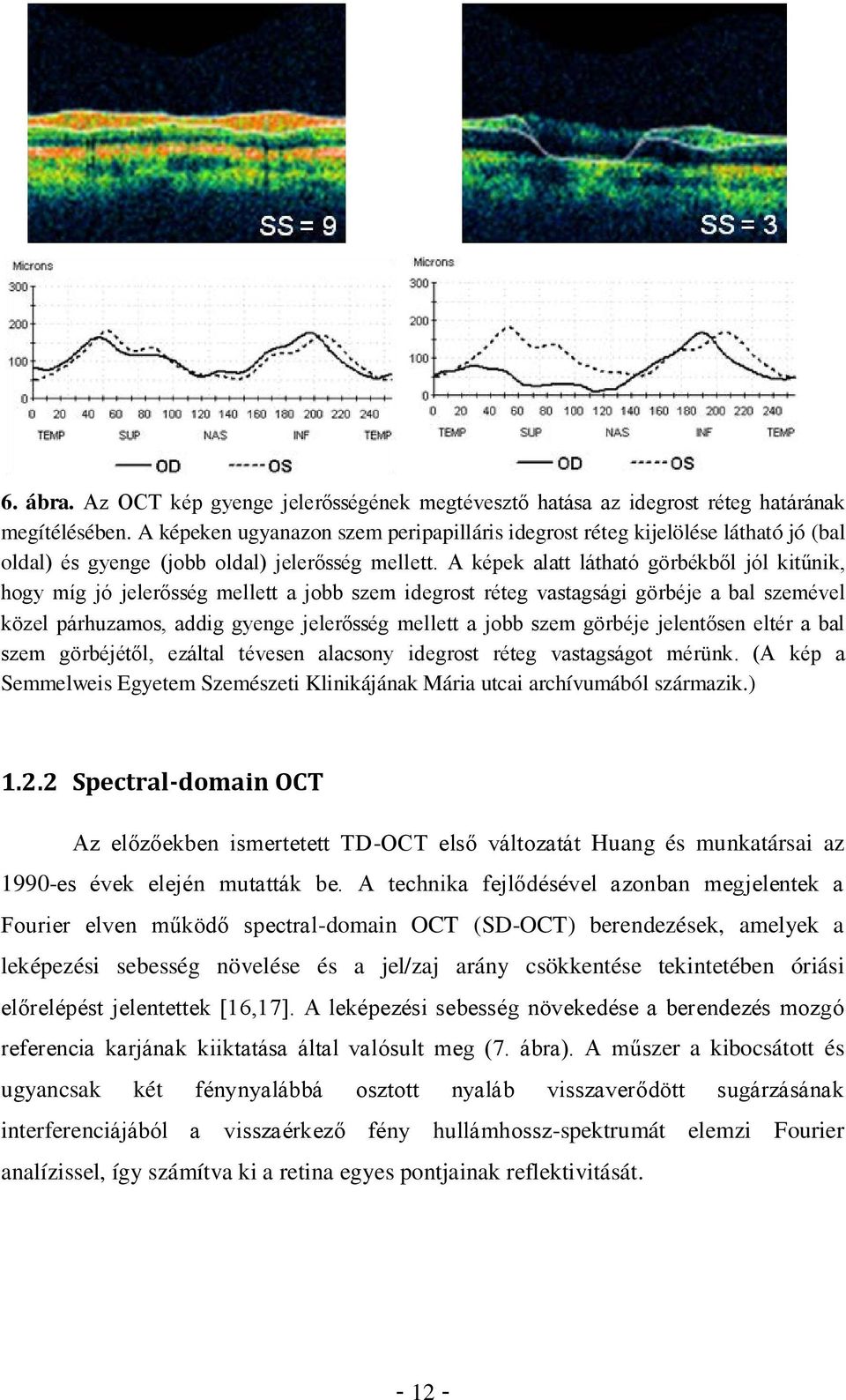 A képek alatt látható görbékből jól kitűnik, hogy míg jó jelerősség mellett a jobb szem idegrost réteg vastagsági görbéje a bal szemével közel párhuzamos, addig gyenge jelerősség mellett a jobb szem