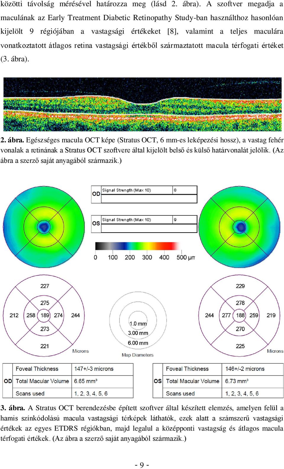 átlagos retina vastagsági értékből származtatott macula térfogati értéket (3. ábra)