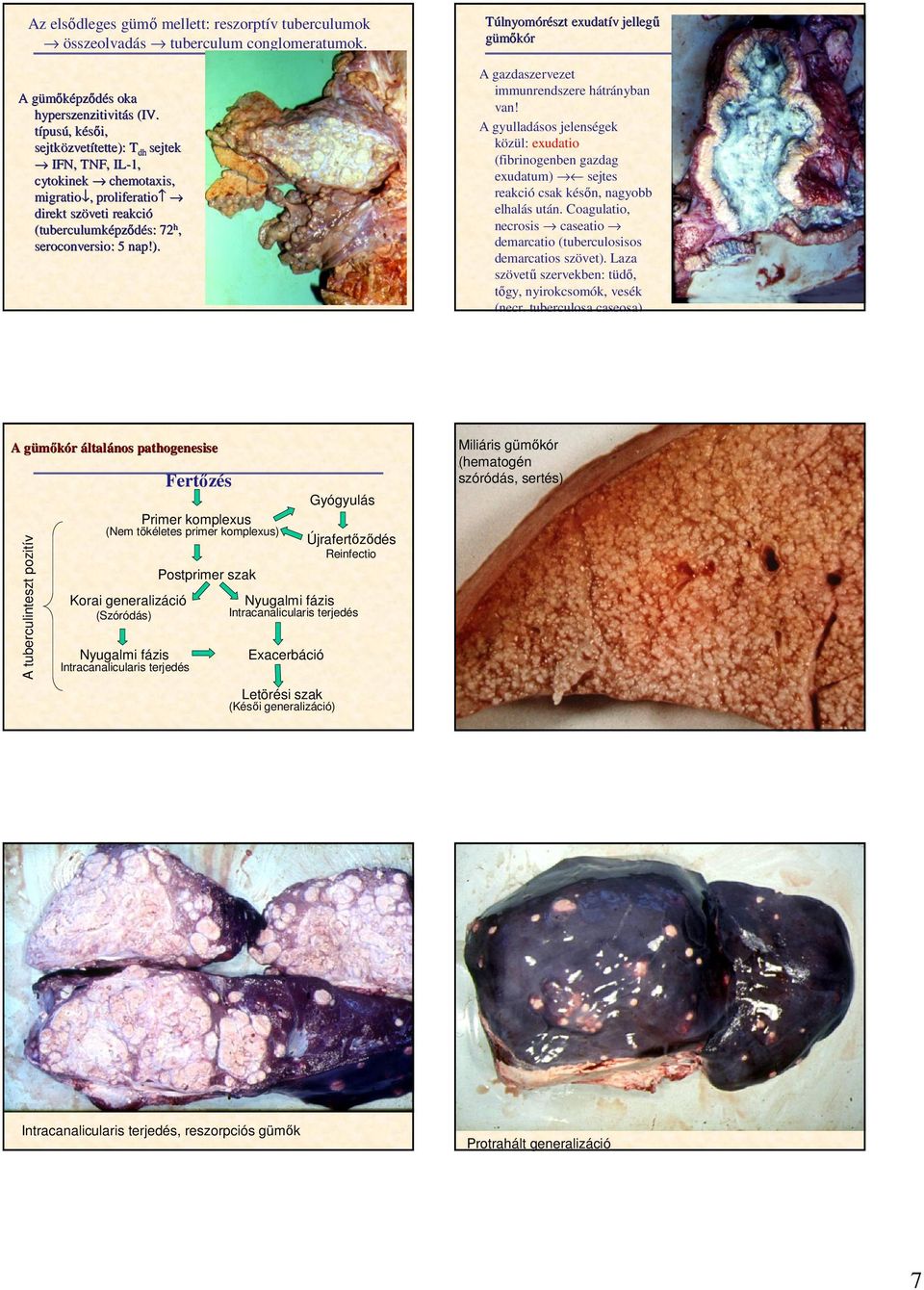 A gyulladásos jelenségek közül: exudatio (fibrinogenben gazdag exudatum) sejtes reakció csak késın, nagyobb elhalás után. Coagulatio, necrosis caseatio demarcatio (tuberculosisos demarcatios szövet).