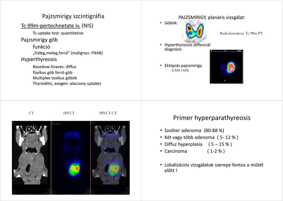 göb Multiplex toxikus göbök Thyroiditis, exogen: alacsony uptake) PAJZSMIRIGY, planáris vizsgálat: Göbök: Hyperthyreosis diffenciál diagnózis Ektópiás