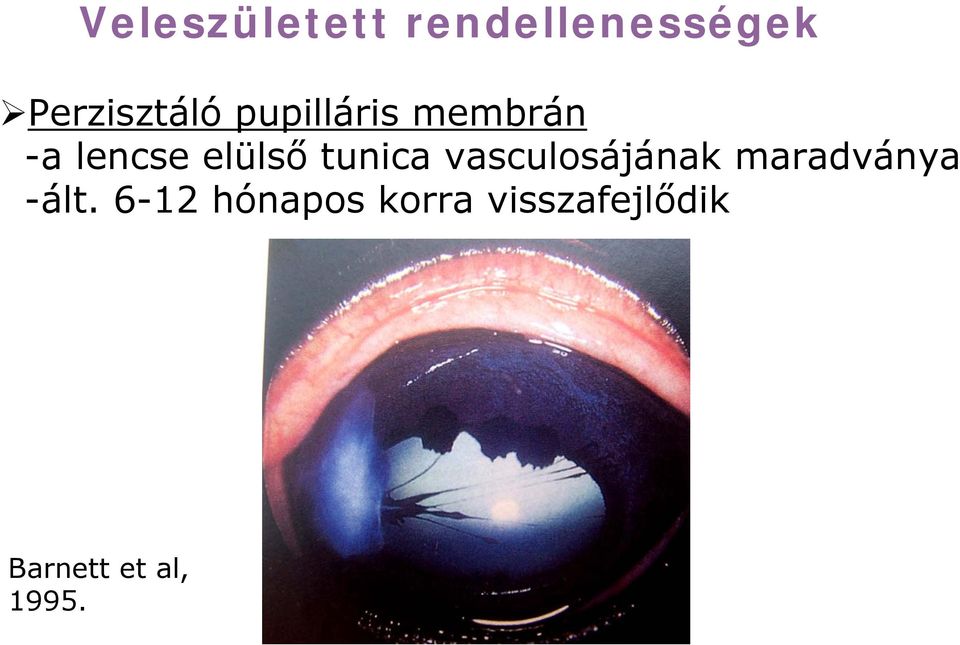 vasculosájának maradványa -ált.