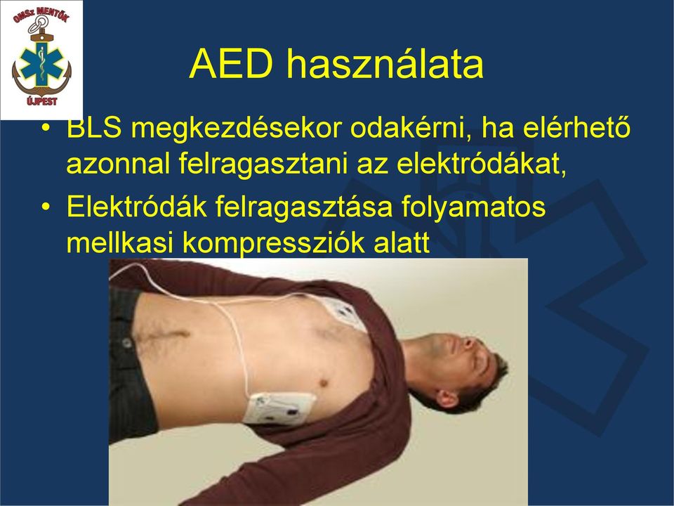 felragasztani az elektródákat,