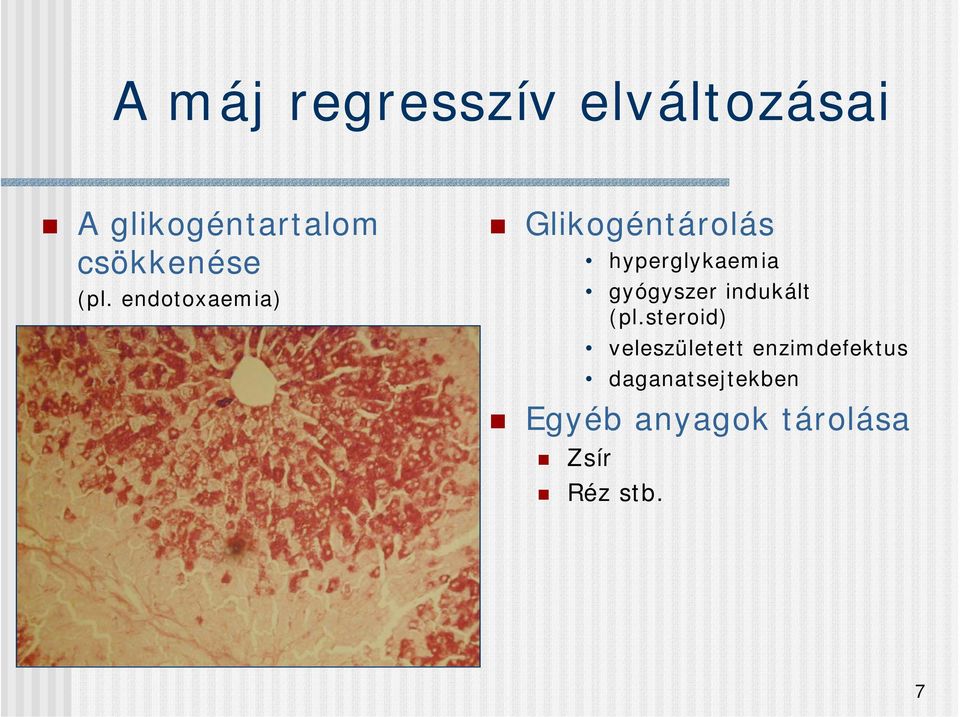 endotoxaemia) Glikogéntárolás hyperglykaemia gyógyszer
