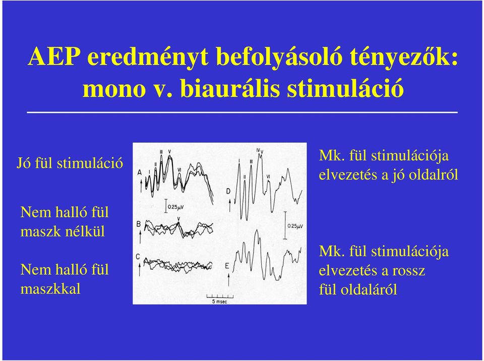 maszk nélkül Nem halló fül maszkkal Mk.