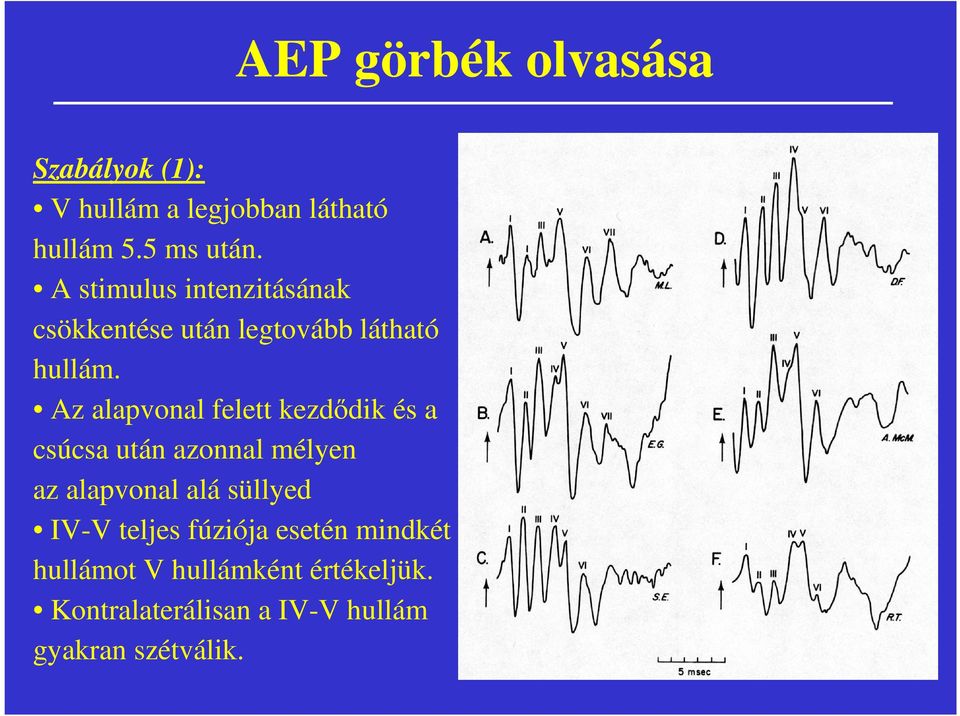 Az alapvonal felett kezdődik és a csúcsa után azonnal mélyen az alapvonal alá süllyed