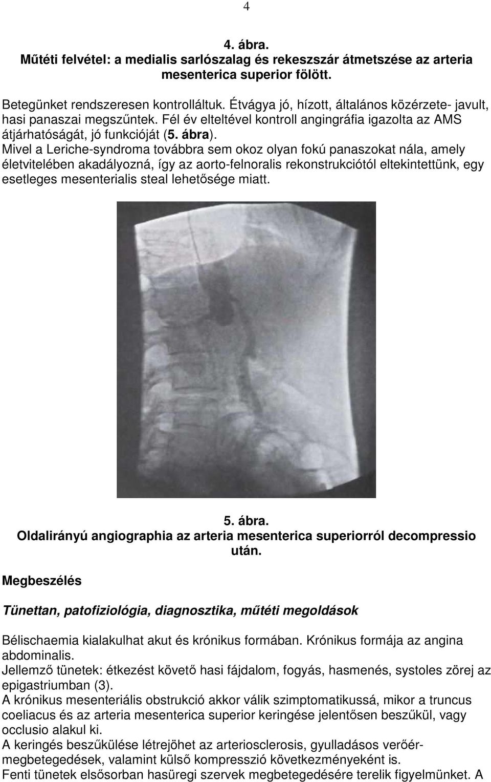 Mivel a Leriche-syndroma továbbra sem okoz olyan fokú panaszokat nála, amely életvitelében akadályozná, így az aorto-felnoralis rekonstrukciótól eltekintettünk, egy esetleges mesenterialis steal