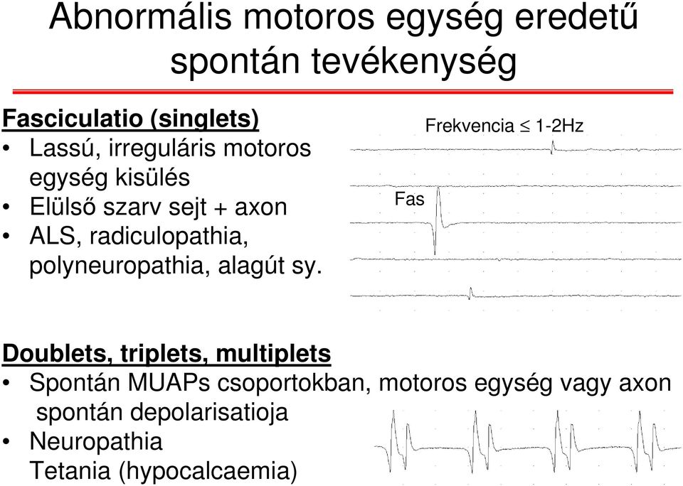 polyneuropathia, alagút sy.