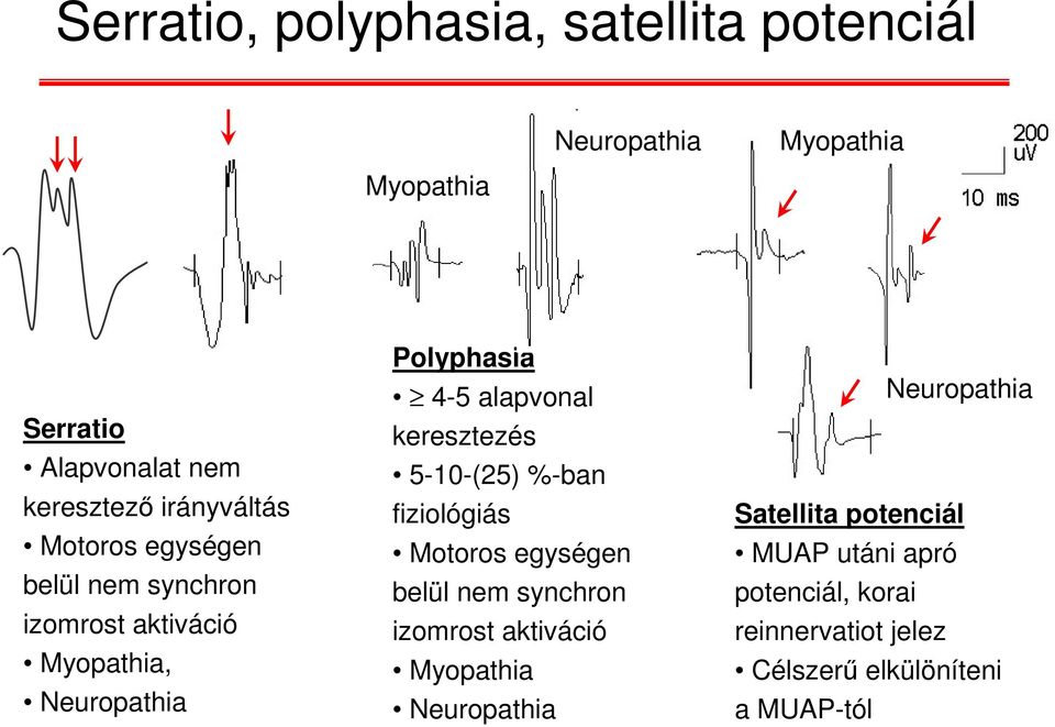 keresztezés 5-10-(25) %-ban fiziológiás Motoros egységen belül nem synchron izomrost aktiváció Myopathia