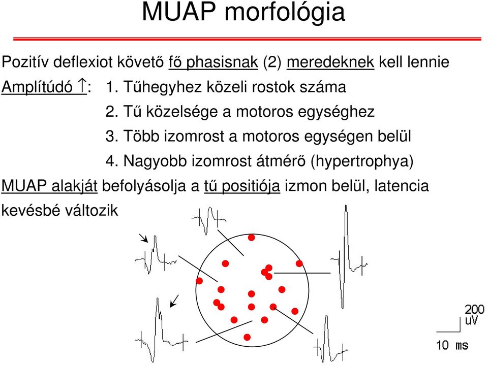 Tű közelsége a motoros egységhez 3. Több izomrost a motoros egységen belül 4.