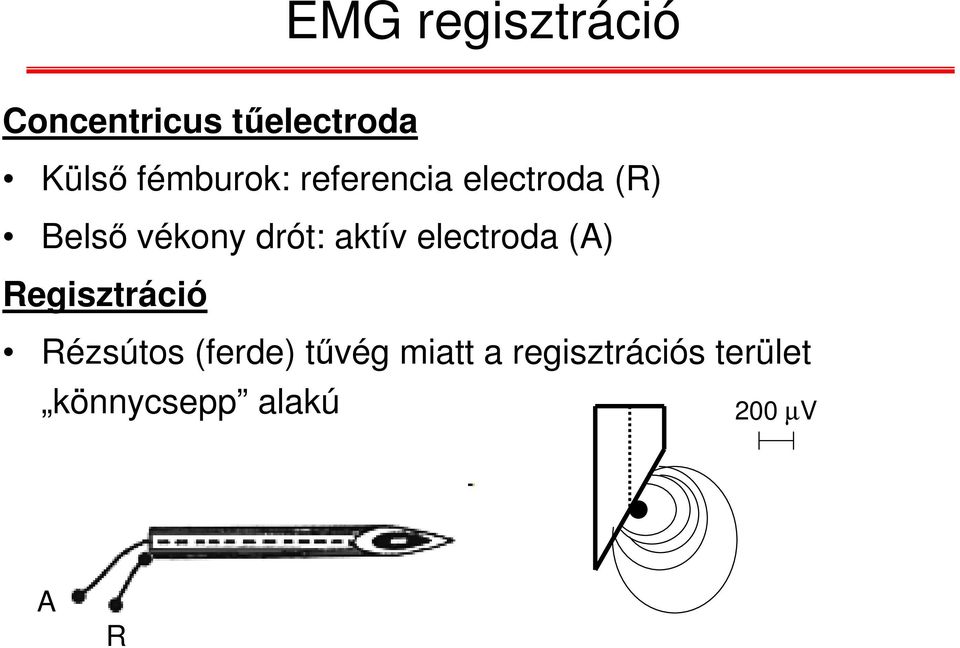 aktív electroda (A) Regisztráció Rézsútos (ferde)