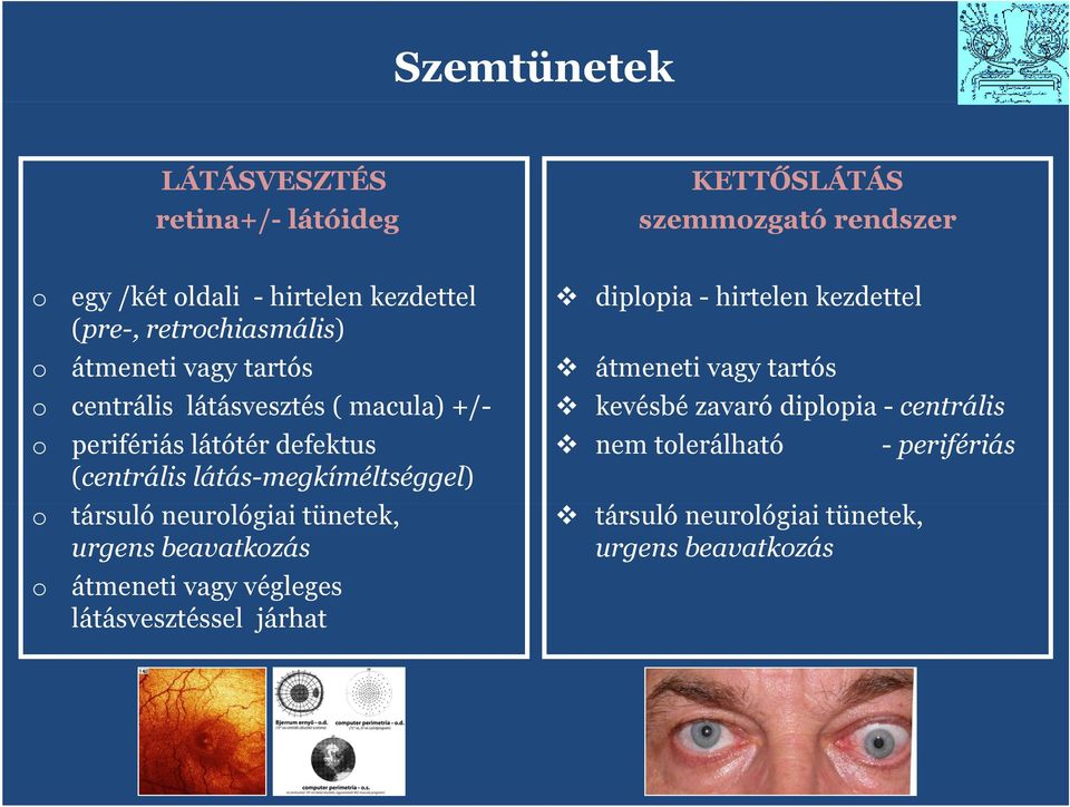 látás-megkíméltséggel) társuló neurlógiai tünetek, urgens beavatkzás átmeneti vagy végleges látásvesztéssel járhat diplpia -