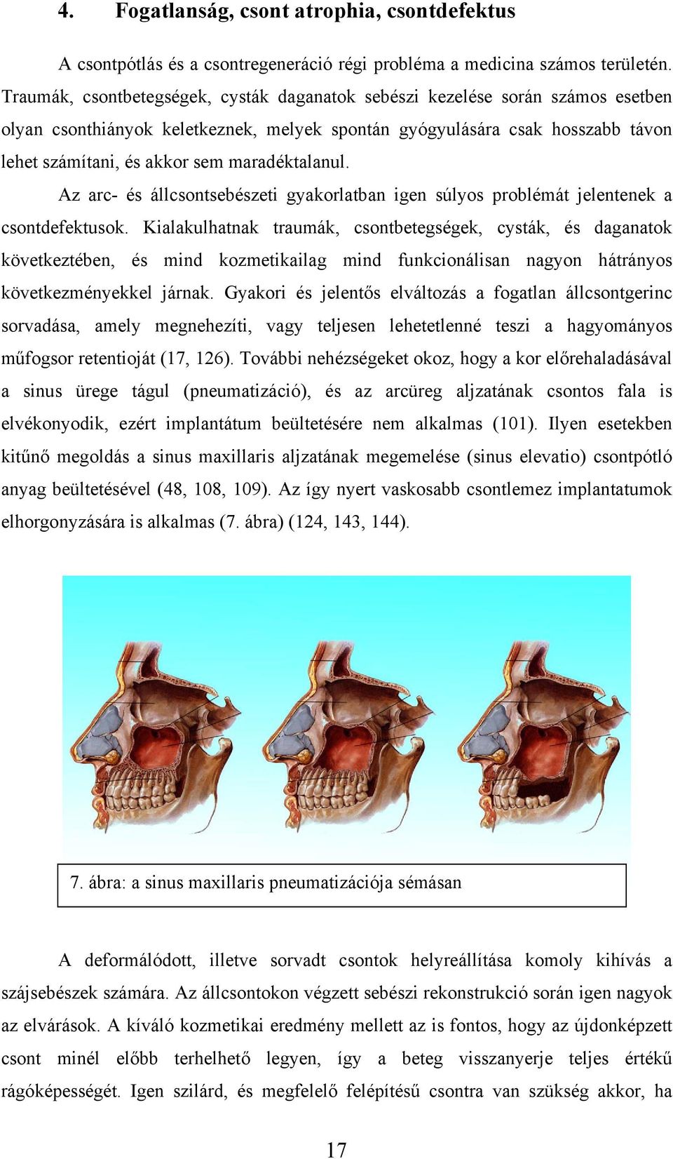 maradéktalanul. Az arc- és állcsontsebészeti gyakorlatban igen súlyos problémát jelentenek a csontdefektusok.