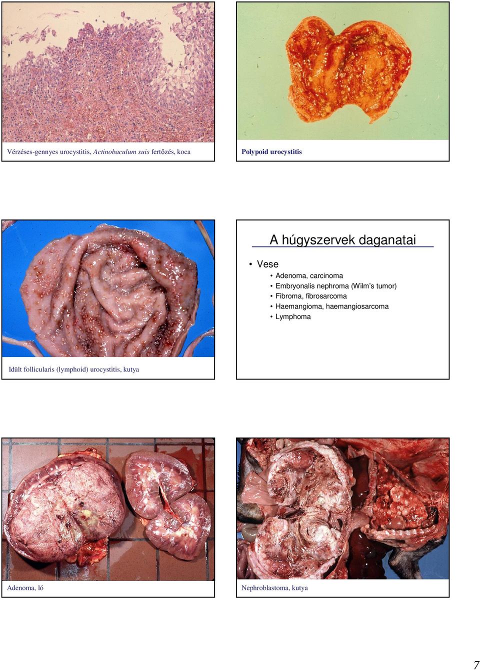 nephroma (Wilm s tumor) Fibroma, fibrosarcoma Haemangioma, haemangiosarcoma