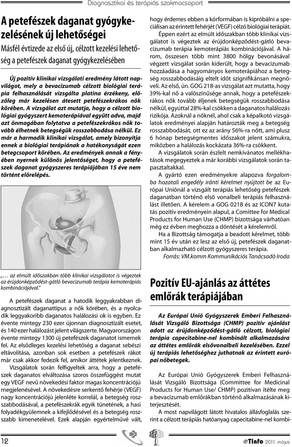 A vizsgálat azt mutatja, hogy a célzott biológiai gyógyszert kemoterápiával együtt adva, majd azt önmagában folytatva a petefészekrákos nők tovább élhetnek betegségük rosszabbodása nélkül.