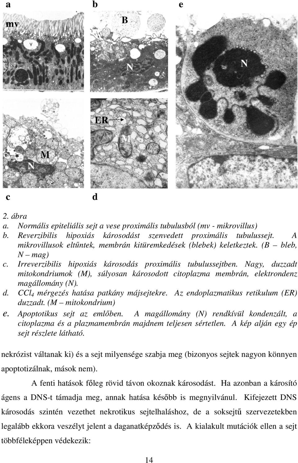 Nagy, duzzadt mitokondriumok (M), súlyosan károsodott citoplazma membrán, elektrondenz magállomány (N). d. CCl 4 mérgezés hatása patkány májsejtekre. Az endoplazmatikus retikulum (ER) duzzadt.