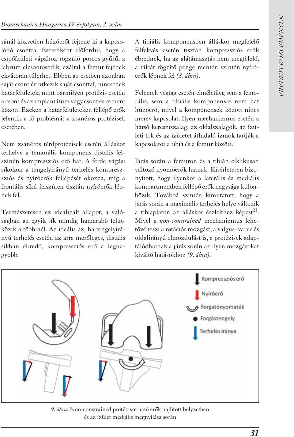 Ebben az esetben azonban saját csont érintkezik saját csonttal, nincsenek határfelületek, mint bármilyen protézis esetén a csont és az implantátum vagy csont és cement között.