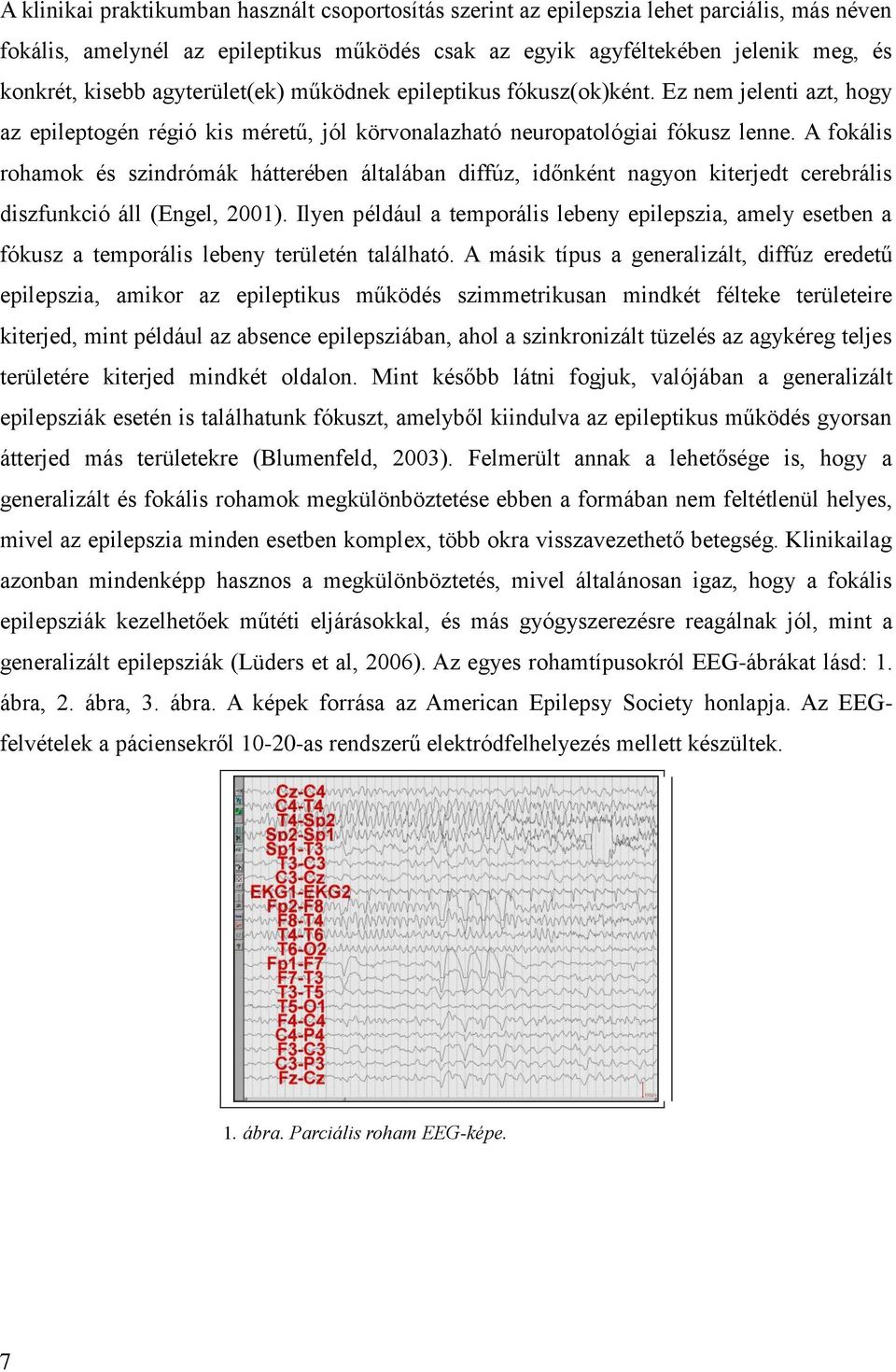 A fokális rohamok és szindrómák hátterében általában diffúz, időnként nagyon kiterjedt cerebrális diszfunkció áll (Engel, 2001).